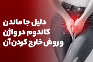دلیل جا ماندن کاندوم در واژن و روش خارج کردن آن