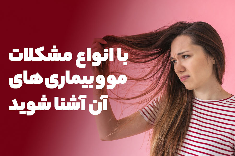 با انواع مشکلات و بیماری‌های مو آشنا شوید